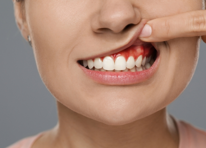 should you get your gums checked the 5 signs to look out for